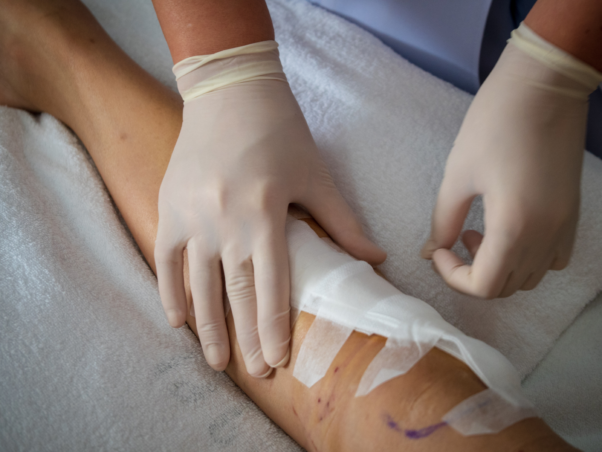 Luka Tak Kunjung Sembuh? Kesalahan Perawatan yang Sering Tidak Disadari